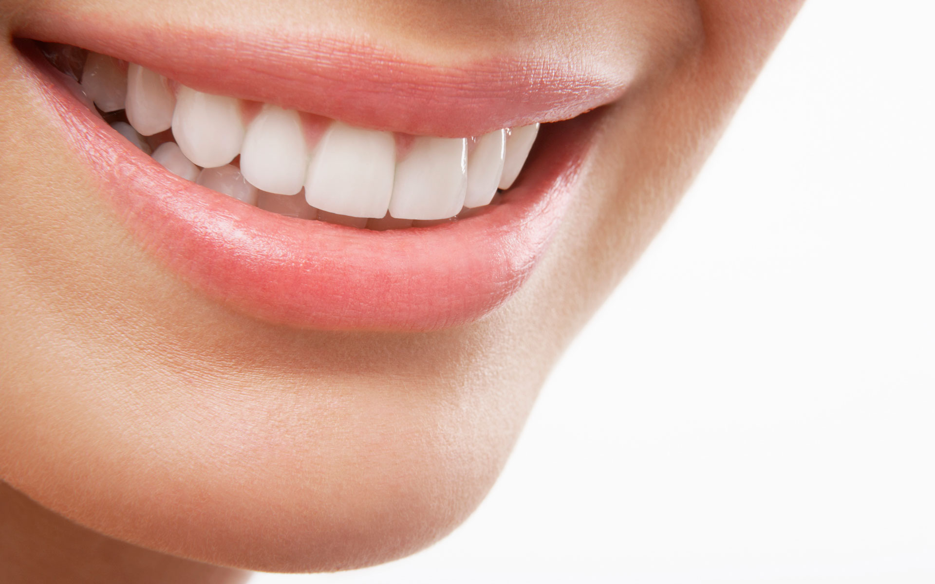 Veneers Downey - Your Downey Dentist